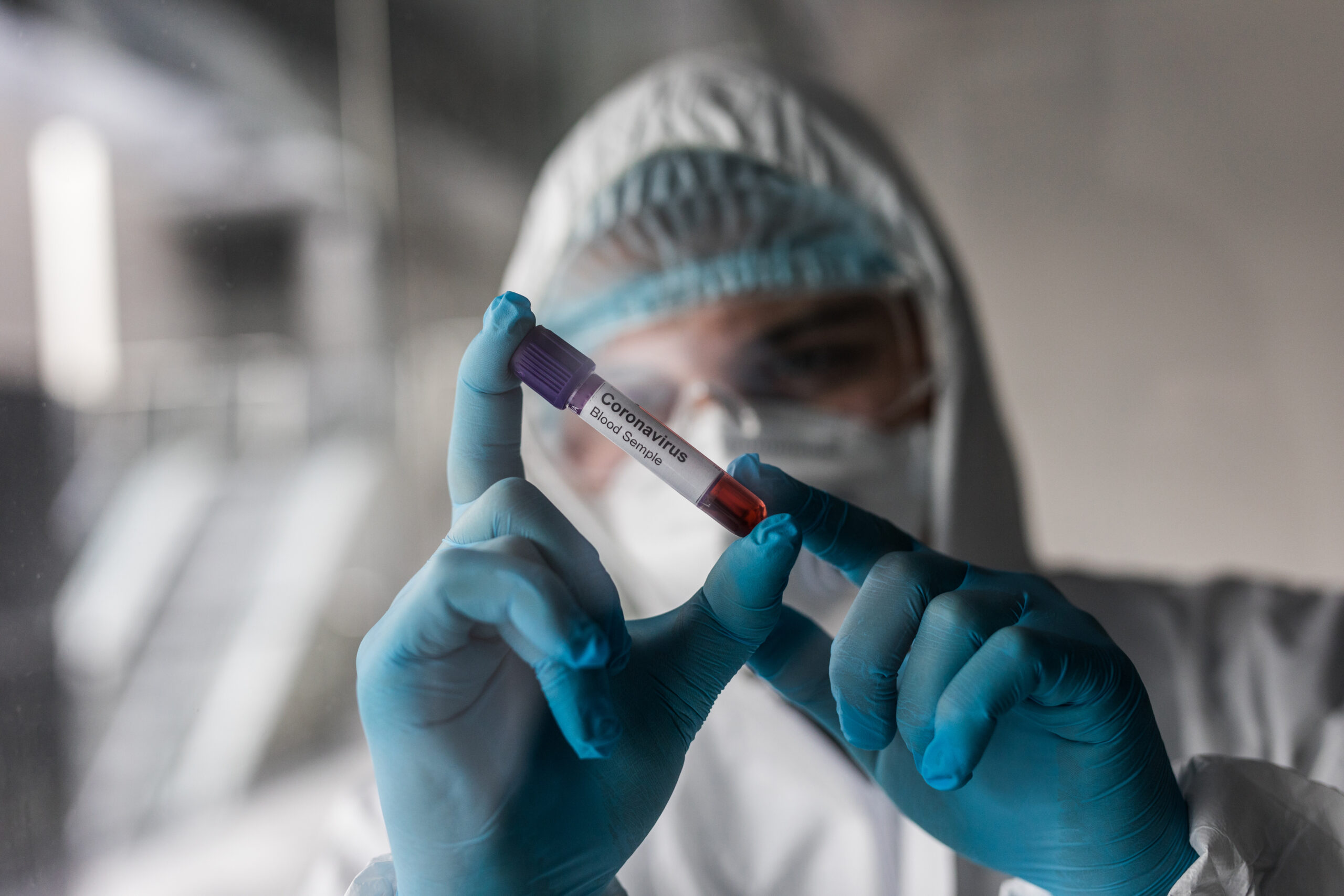 CARE Announces Grant Awards for COVID-19 Response
